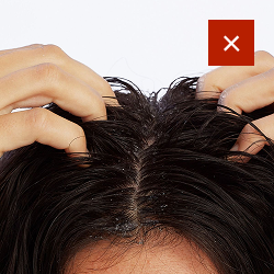 Do not apply on scalp